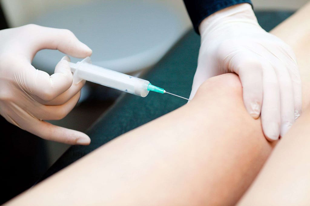 steroid injection to knee